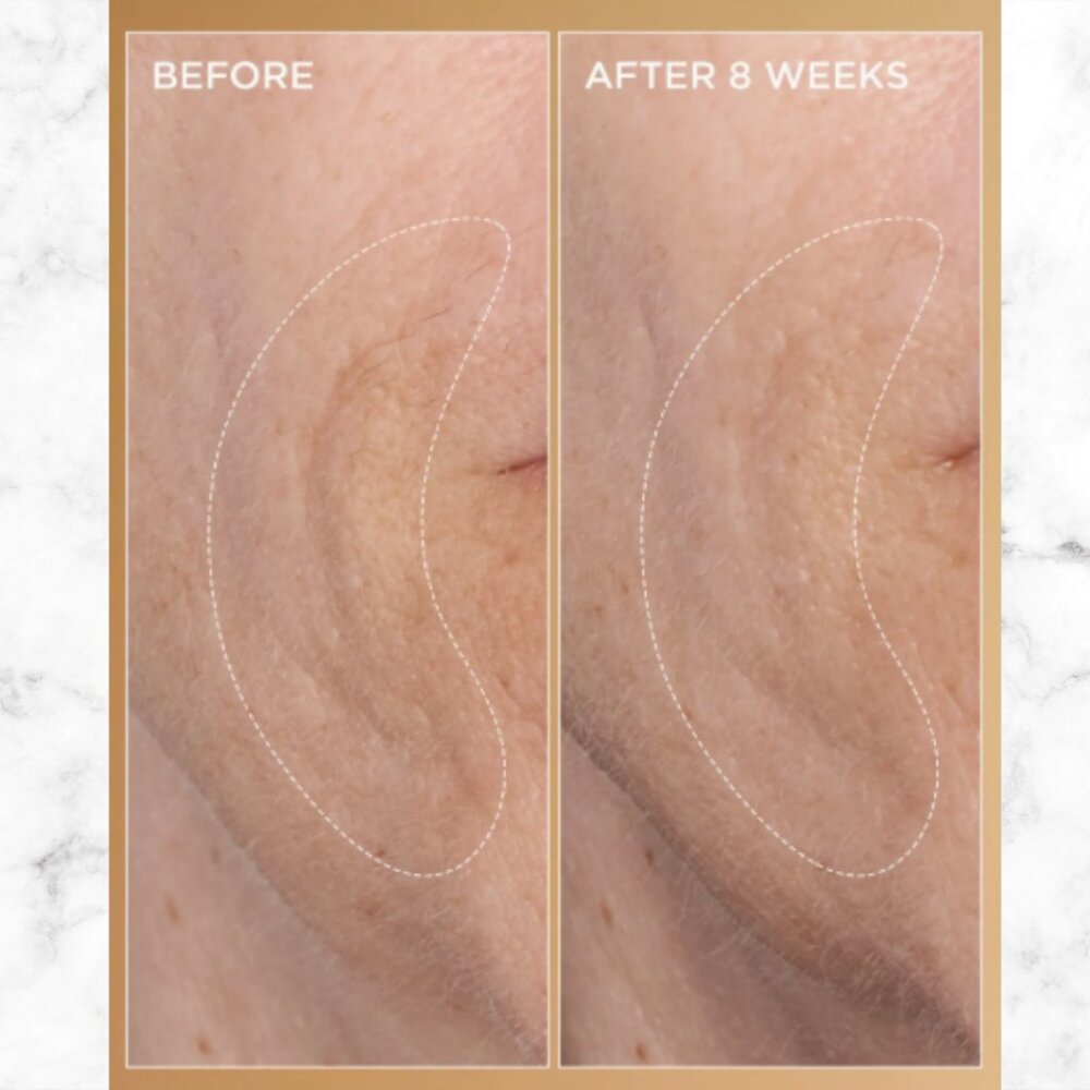 NIB | PERRICONE MD Neuropeptide Pro-Strength Firming Moisturizer | Anti-Aging - Picture 4 of 8